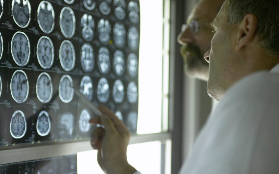 Two doctors examining brain MRI scans